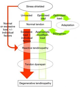 how-to-treat-tendinopathy