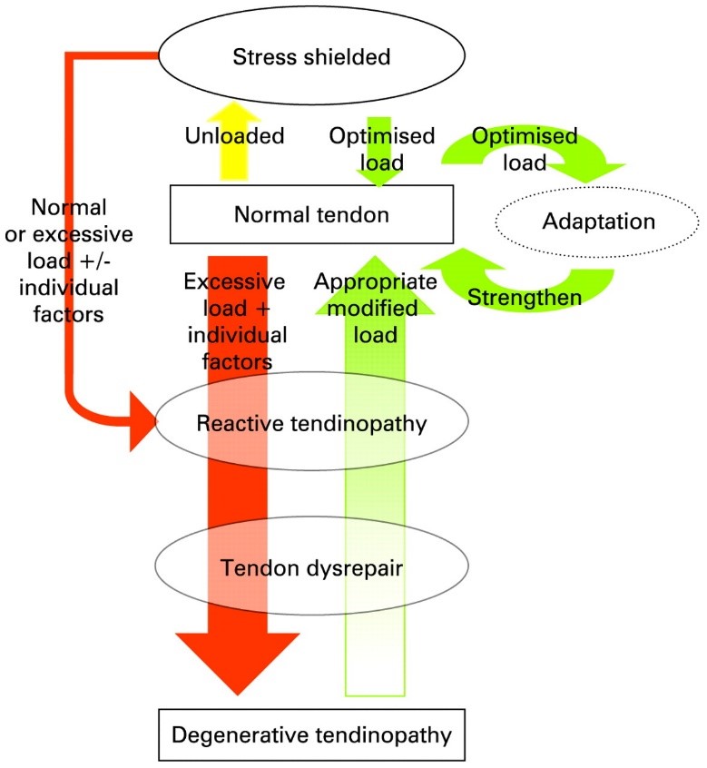 Using load management in the treatment of tendinopathy - Inspire ...